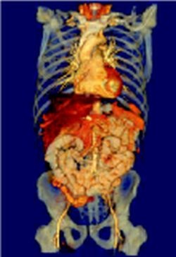 Contrast Enhanced abdominal CT in different display settings (one patient)