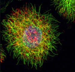 Proteins (in red) are transported along a intracellular highway (microtubules,...