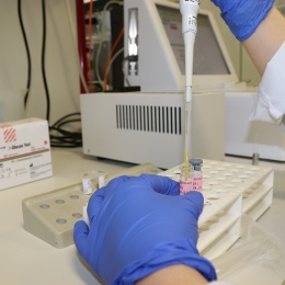 Photo: New test for early fungal infection detection