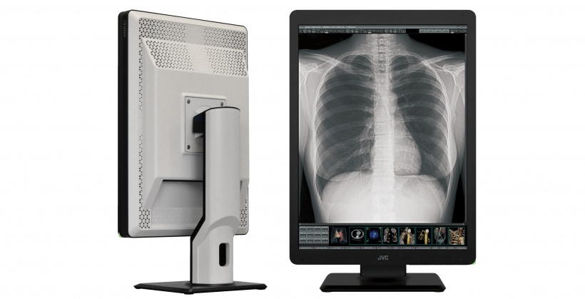 New monitor generation for better diagnosis